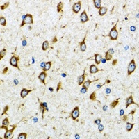 AKTIP Rabbit Polyclonal Antibody