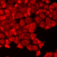 TSSC3 Rabbit Polyclonal Antibody
