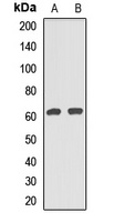 CAF-I p60 Rabbit Polyclonal Antibody