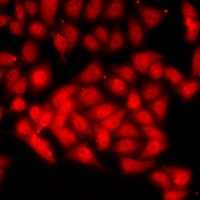 CAF-I p60 Rabbit Polyclonal Antibody