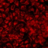 Kv1.2 Rabbit Polyclonal Antibody