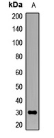 LPAAT beta Rabbit Polyclonal Antibody