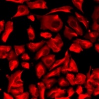 LPAAT beta Rabbit Polyclonal Antibody