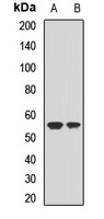 EIF5 Rabbit Polyclonal Antibody