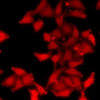 EIF5 Rabbit Polyclonal Antibody