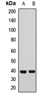 SLM2 Rabbit Polyclonal Antibody