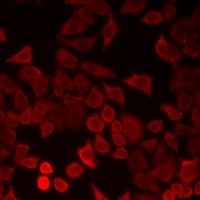 LECT1 Rabbit Polyclonal Antibody