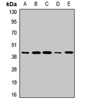 RAMP3 Rabbit Polyclonal Antibody