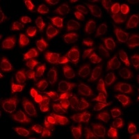 RAMP3 Rabbit Polyclonal Antibody