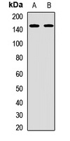 BCL9 Rabbit Polyclonal Antibody