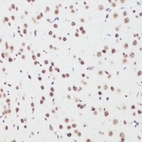 BCL9 Rabbit Polyclonal Antibody