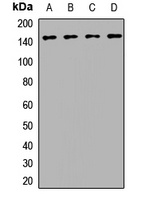 BRIP1 Rabbit Polyclonal Antibody