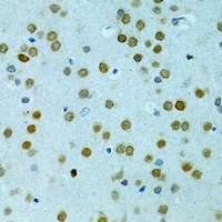 MUS81 Rabbit Polyclonal Antibody