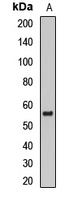 DGAT1 Rabbit Polyclonal Antibody