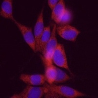 DGAT1 Rabbit Polyclonal Antibody