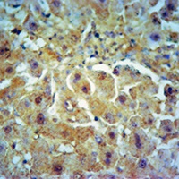 Collagen 10 alpha 1 Antibody