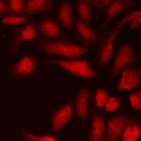 Cyclophilin D Rabbit Polyclonal Antibody
