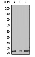 WRB Rabbit Polyclonal Antibody