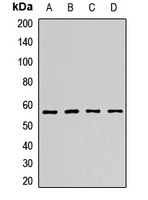 NMT2 Rabbit Polyclonal Antibody