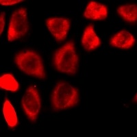 NMT2 Rabbit Polyclonal Antibody