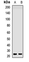 HAND2 Rabbit Polyclonal Antibody