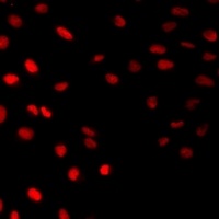 HAND2 Rabbit Polyclonal Antibody