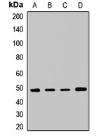 VPS4A Rabbit Polyclonal Antibody
