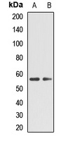 TPH2 Rabbit Polyclonal Antibody