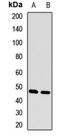 FOXN2 Rabbit Polyclonal Antibody