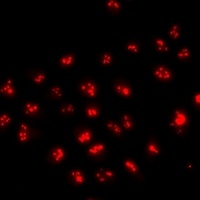 FOXN2 Rabbit Polyclonal Antibody