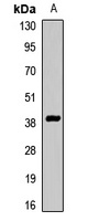 KLF3 Rabbit Polyclonal Antibody