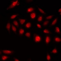 KLF3 Rabbit Polyclonal Antibody