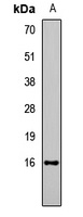 Histone H3 (Acetyl-K14) Antibody