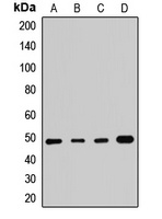 SMYD3 Rabbit Polyclonal Antibody