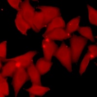 SMYD3 Rabbit Polyclonal Antibody