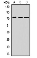 ZNF264 Rabbit Polyclonal Antibody