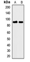 CSRP2BP Rabbit Polyclonal Antibody