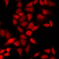 CSRP2BP Rabbit Polyclonal Antibody