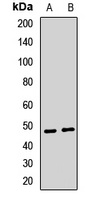 Cytochrome P450 2C18 Rabbit Polyclonal Antibody