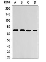 ZNF169 Rabbit Polyclonal Antibody