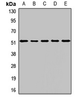 BRK Rabbit Polyclonal Antibody