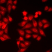 BRK Rabbit Polyclonal Antibody