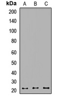 RAB1B Rabbit Polyclonal Antibody