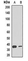 COX1 Rabbit Polyclonal Antibody