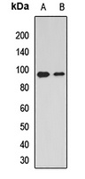 Dishevelled 2 Rabbit Polyclonal Antibody