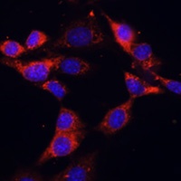 Dishevelled 2 Rabbit Polyclonal Antibody