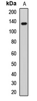 TTBK2 Rabbit Polyclonal Antibody