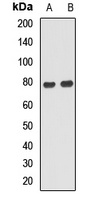 ANKS1B Rabbit Polyclonal Antibody
