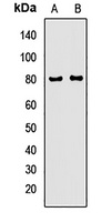 AMPD1 Rabbit Polyclonal Antibody