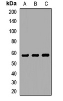 CHRNG Rabbit Polyclonal Antibody